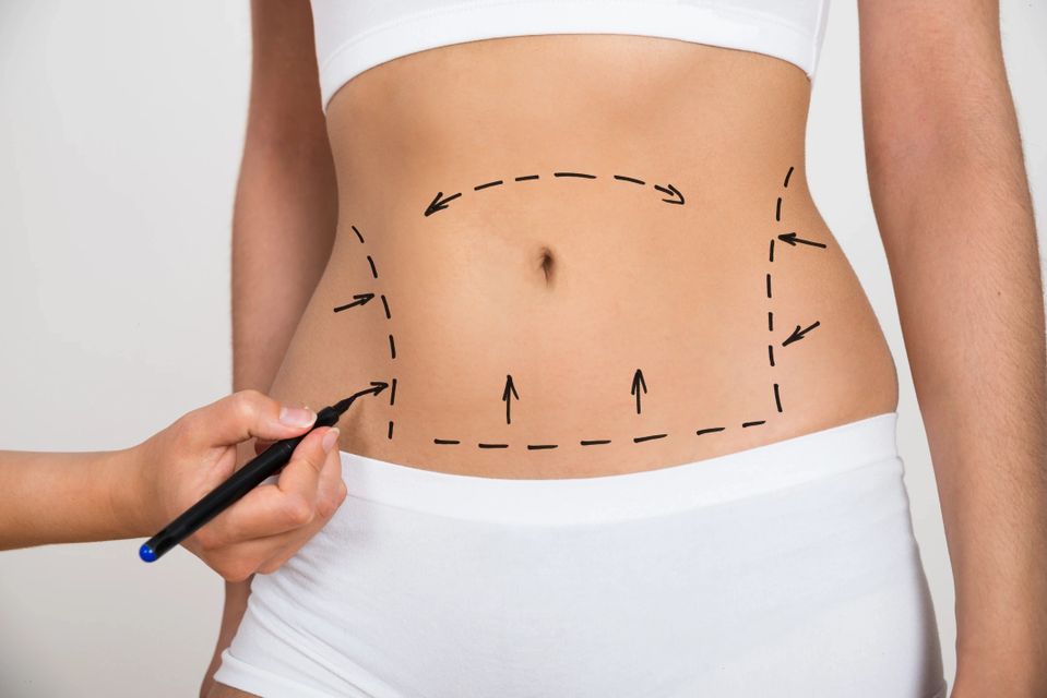 Rf Skin Tightening, Belly. Hardware Cosmetology. Body Care. Non Surgical Body  Sculpting Stock Photo - Image of cavitation, body: 142611546